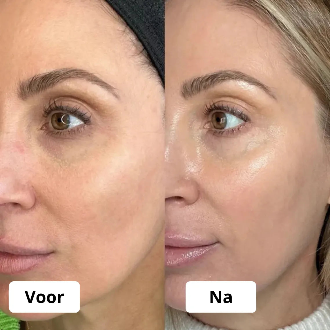 Glow up Koreaanse Collageen Nachtmasker